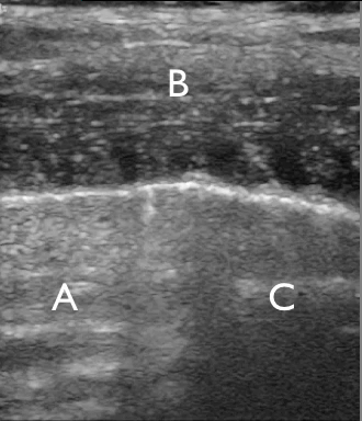 EEU case image missing